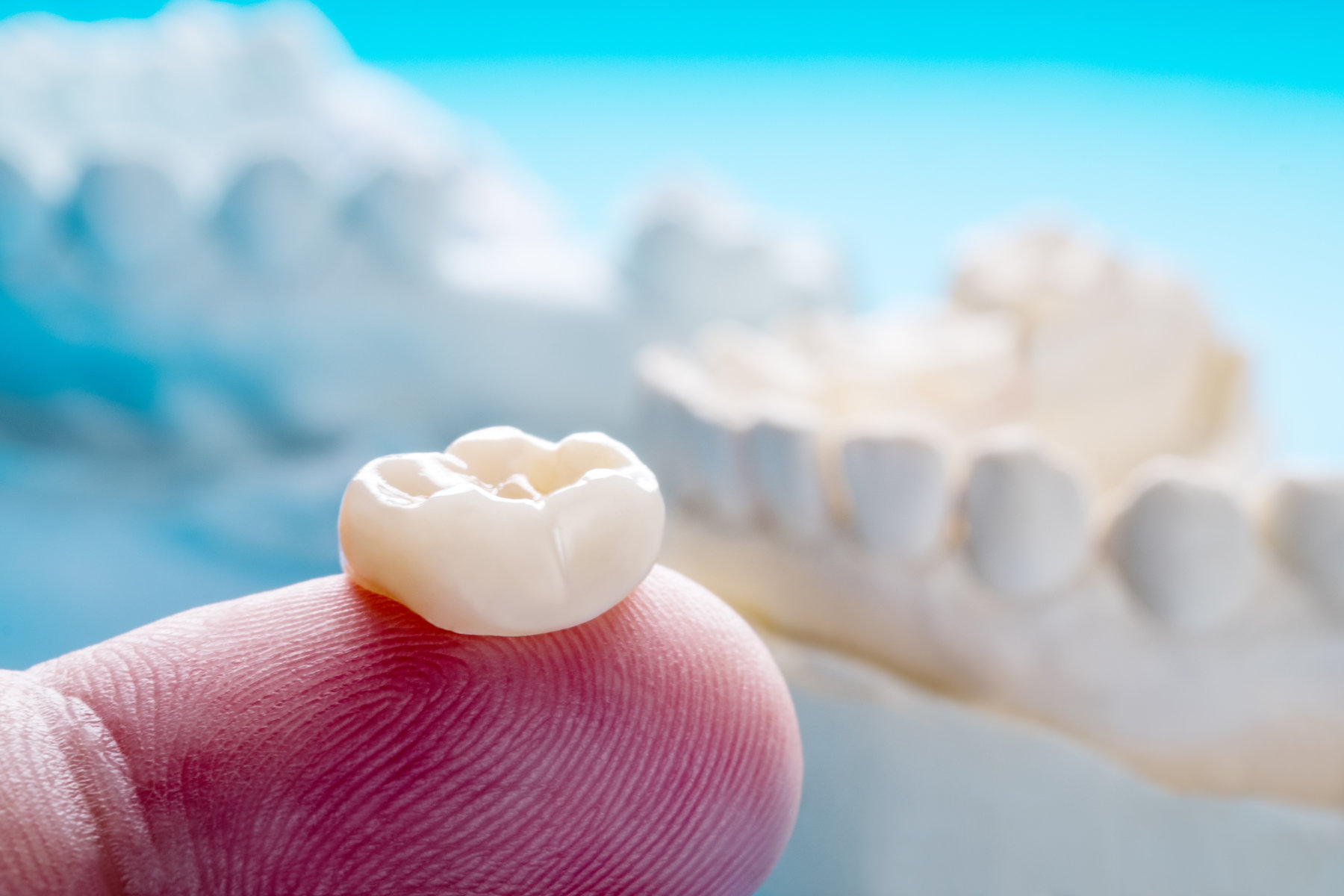Closeup / Prosthodontics or Prosthetic / Single teeth crown and bridge equipment model express fix restoration.